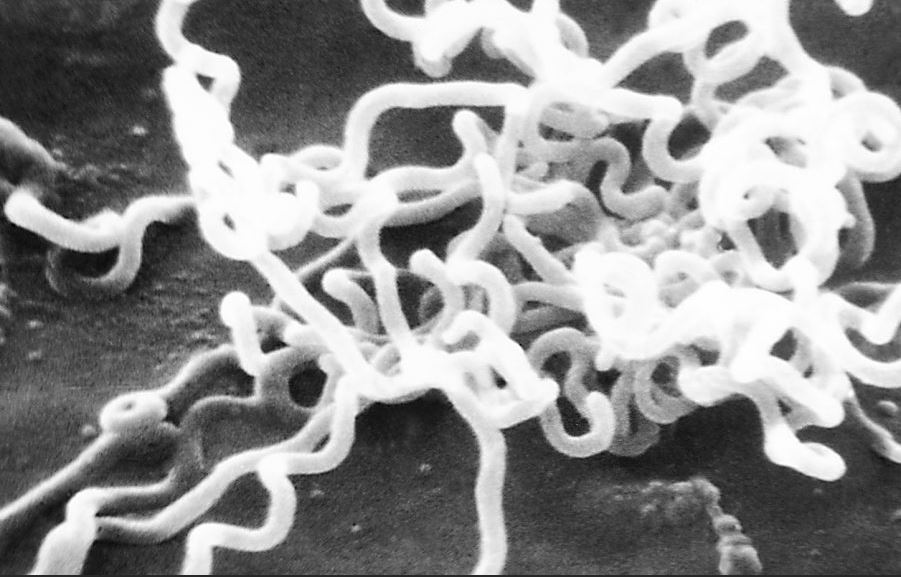 Syphilis virus under magnification